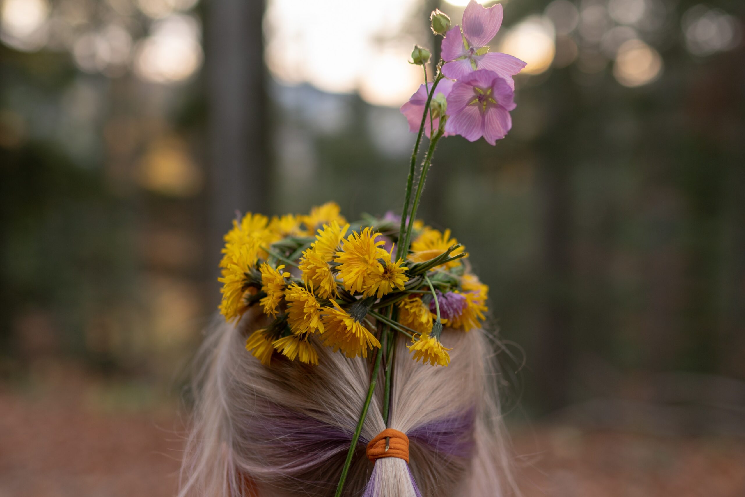 Hair toppers gaining confidence after hair loss